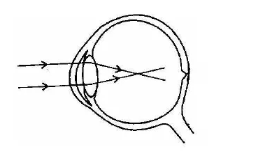 Figure for this question