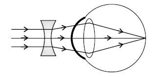 Figure for this question