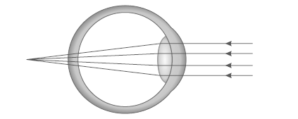 Figure for this question