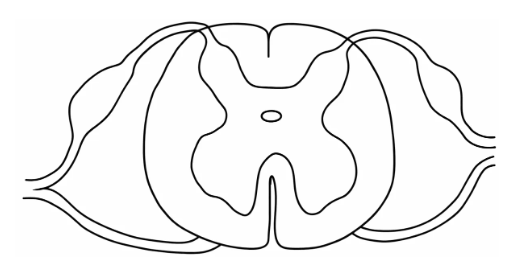 Diagram for question 6(v)